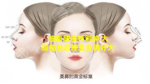 抽脂膝盖特别肿 大腿抽脂后膝盖变得好大